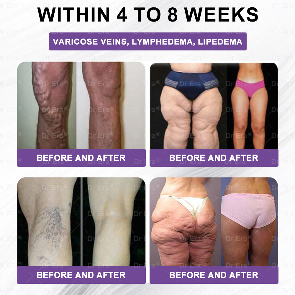 As a 𝐃𝐫 𝐄𝐫𝐚® lucky customer, you have one more chance to enjoy a 50% discount on your next shopping spree!